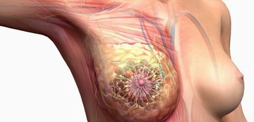 Memede Sert Kitle Belirtileri ve Tedavisi