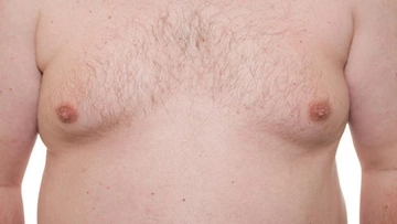 Göğüste Kitle Belirtileri ve Tedavisi